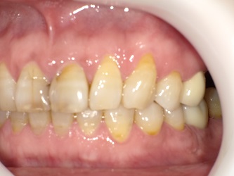 2015-05-22 155254_Std.JPG