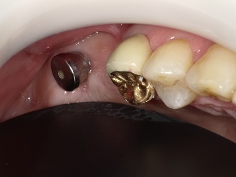 2015-05-22 155333_Std.JPG