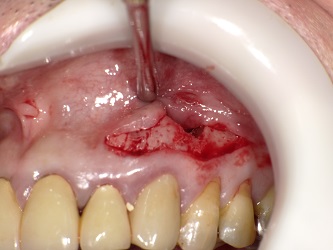 2017-05-13 170703_Std.JPG