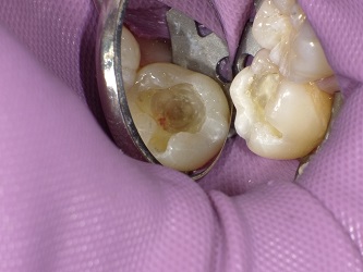 2018-02-03 105749_Std.JPG