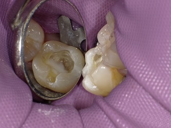 2018-02-03 110253_Std.JPG