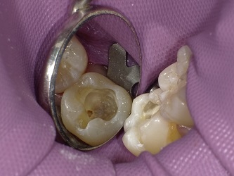 2018-02-03 110502_Std.JPG