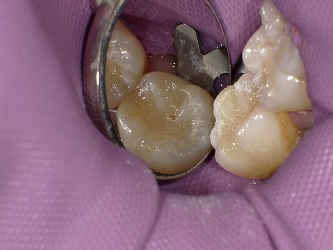 2018-02-03 112218_Std.JPG