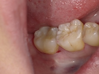 2018-02-03 112835_Std.JPG