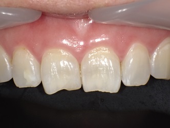 PICT0218 - コピー (3).JPG