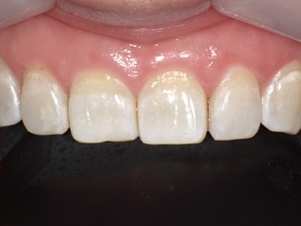 PICT0354 - コピー.JPG